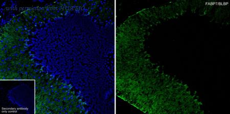 HUABIO HA601411 image 1