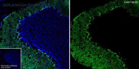 HUABIO HA601411 image 2