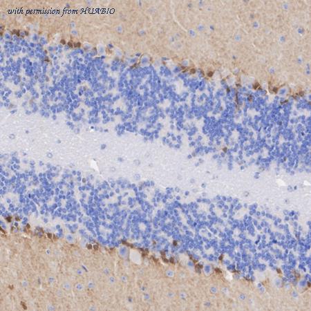 HUABIO HA601411 image 3