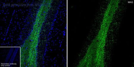 HUABIO HA601414 image 1