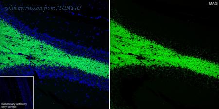 HUABIO HA601414 image 2