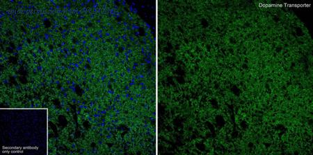 HUABIO HA601474 image 1