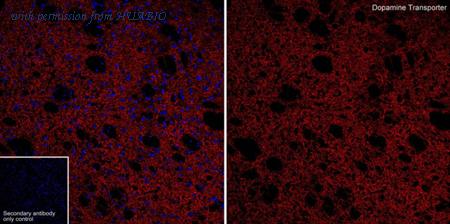 HUABIO HA601475 image 1