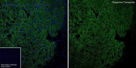 HUABIO HA601476 image 1