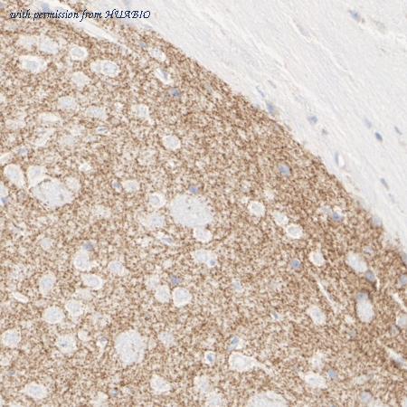 HUABIO HA601476 image 2