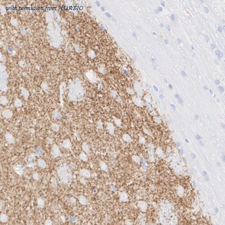 HUABIO HA601476 image 3