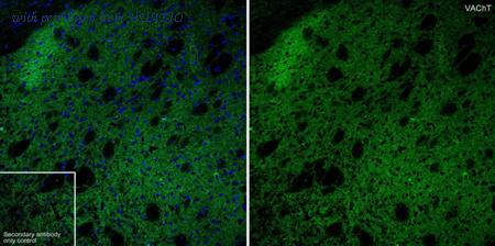 HUABIO HA601477 image 1