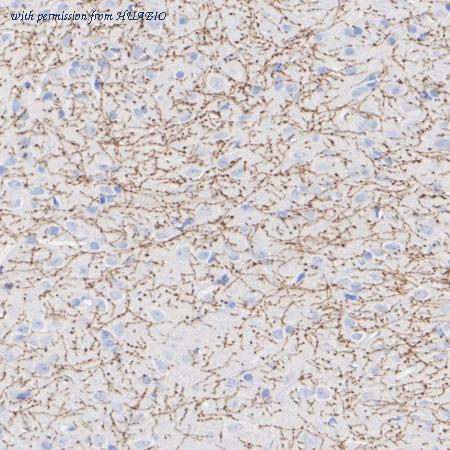 HUABIO HA601493 image 3