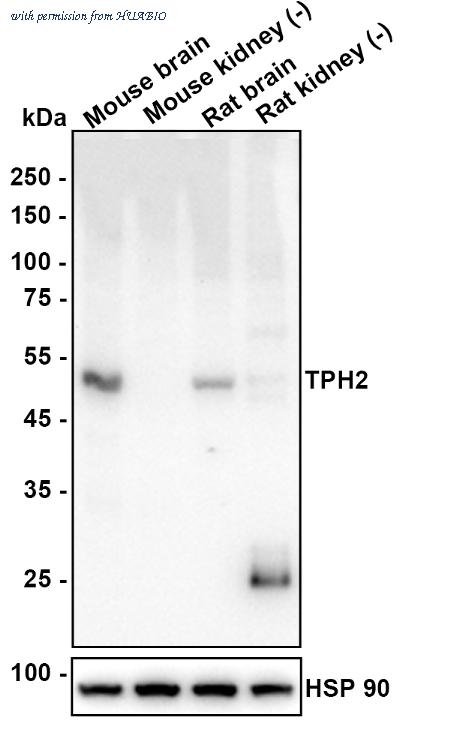 HUABIO HA601494 image 1