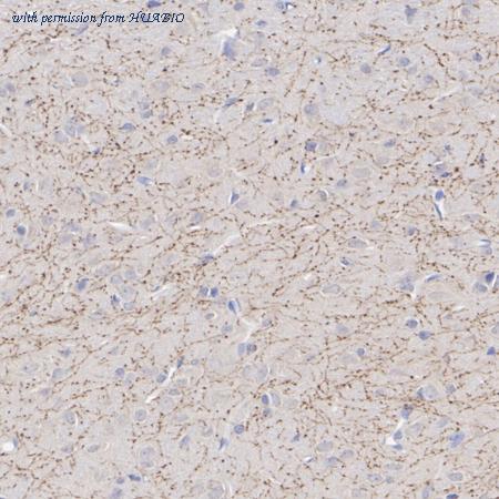 HUABIO HA601494 image 3