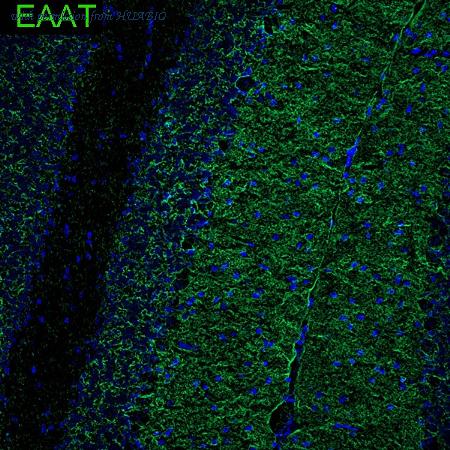 HUABIO HA601503 image 1