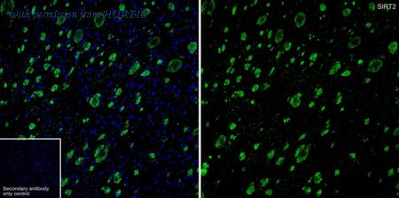 HUABIO HA601506 image 1