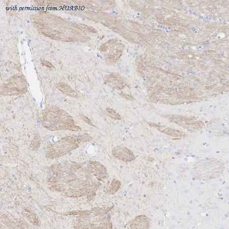 HUABIO HA601506 image 3