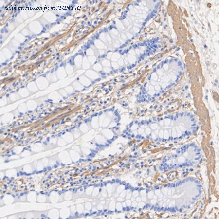 HUABIO HA601546 image 2