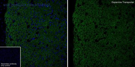 HUABIO HA610244 image 2