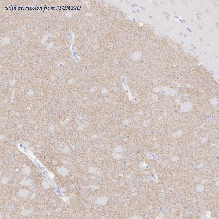 HUABIO HA610244 image 3