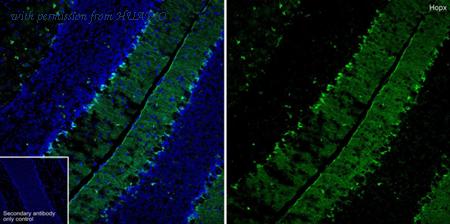 HUABIO HA610318 image 1