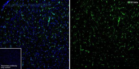 HUABIO HA610366 image 1