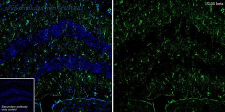 HUABIO HA610366 image 2