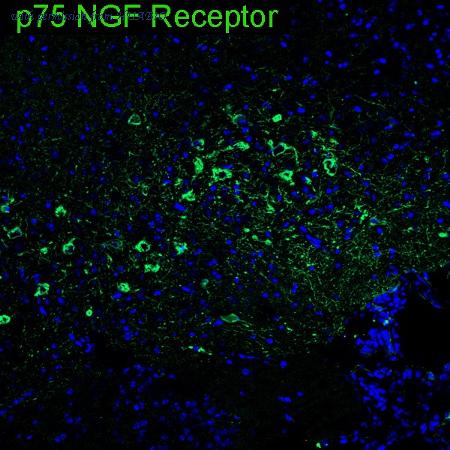 HUABIO HA751462 image 1