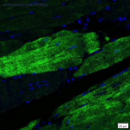 HUABIO IRS145RB image 1