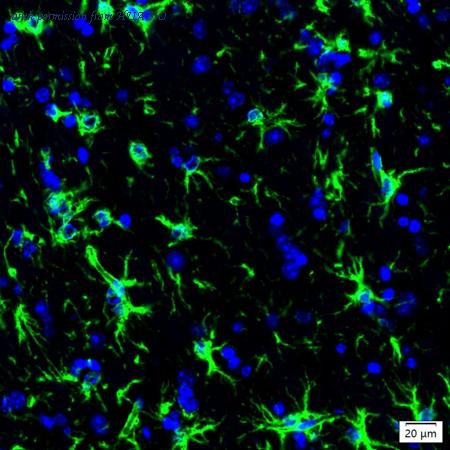 HUABIO IRS148RT image 1