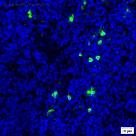 HUABIO IRS210MS image 1