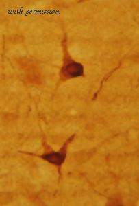 ImmunoStar 24274 image 1