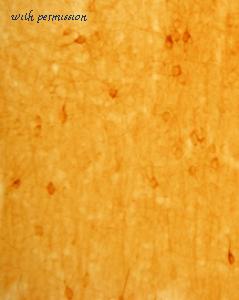 ImmunoStar 24439 image 1