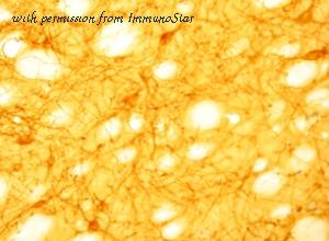 ImmunoStar 20060 image 1