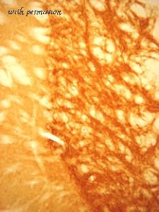 ImmunoStar 20092 image 1
