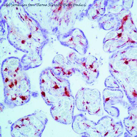 Invitrogen MA5-11751 image 1