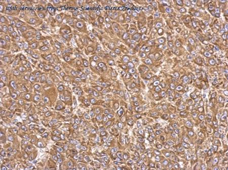 Invitrogen PA5-27137 image 1