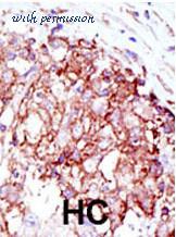 LifeSpan Biosciences LS-C99610 image 3