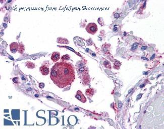 LifeSpan Biosciences LS-B4658 image 1