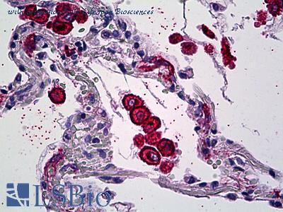 LifeSpan Biosciences LS-B5474 image 3