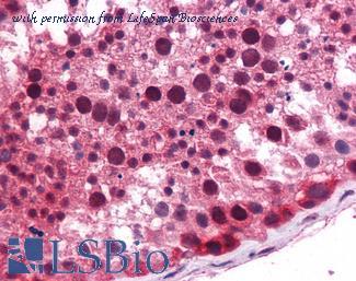 LifeSpan Biosciences LS-B5581 image 1