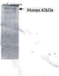 MyBioSource MBS596086 image 1