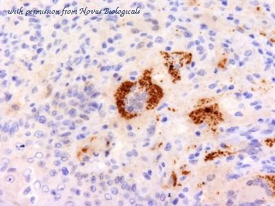 Novus Biologicals NBP2-34372-0.1mg image 1
