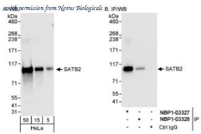 Novus Biologicals NBP1-03328 ͼ 1