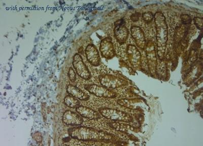 Novus Biologicals NBP1-30865 image 1