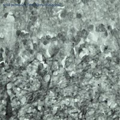 Novus Biologicals NBP1-03494 image 1