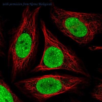 Novus Biologicals NBP2-30603 image 1