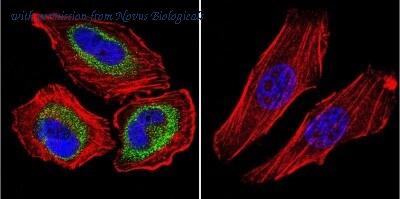 Novus Biologicals NB100-74389 image 1