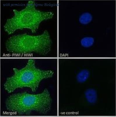 Novus Biologicals NBP1-06062 image 1