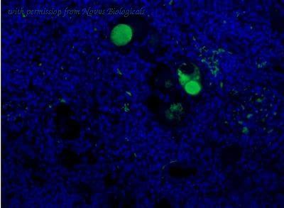 Novus Biologicals NBP1-05122 image 1