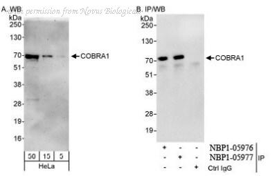 Novus Biologicals NBP1-05977 image 1
