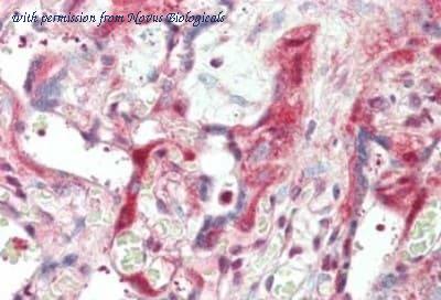 Novus Biologicals NB120-6571 image 1
