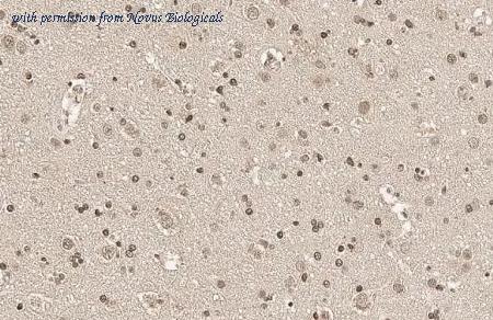 Novus Biologicals NBP3-25693 image 1