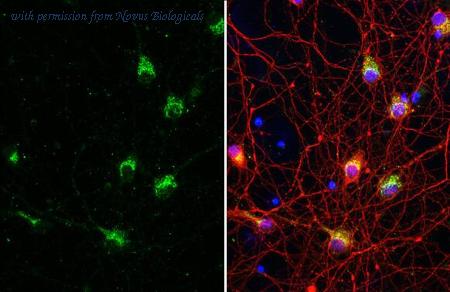 Novus Biologicals NBP3-25535 image 1